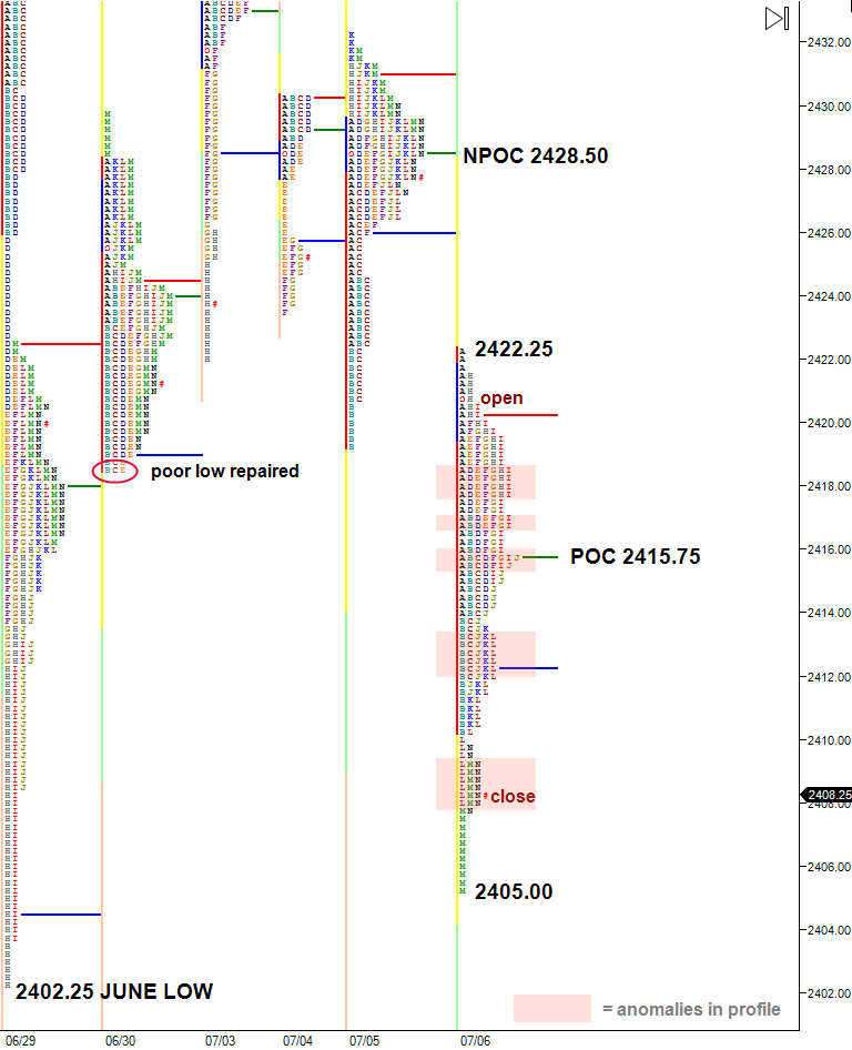 anomalies in market profile chart
